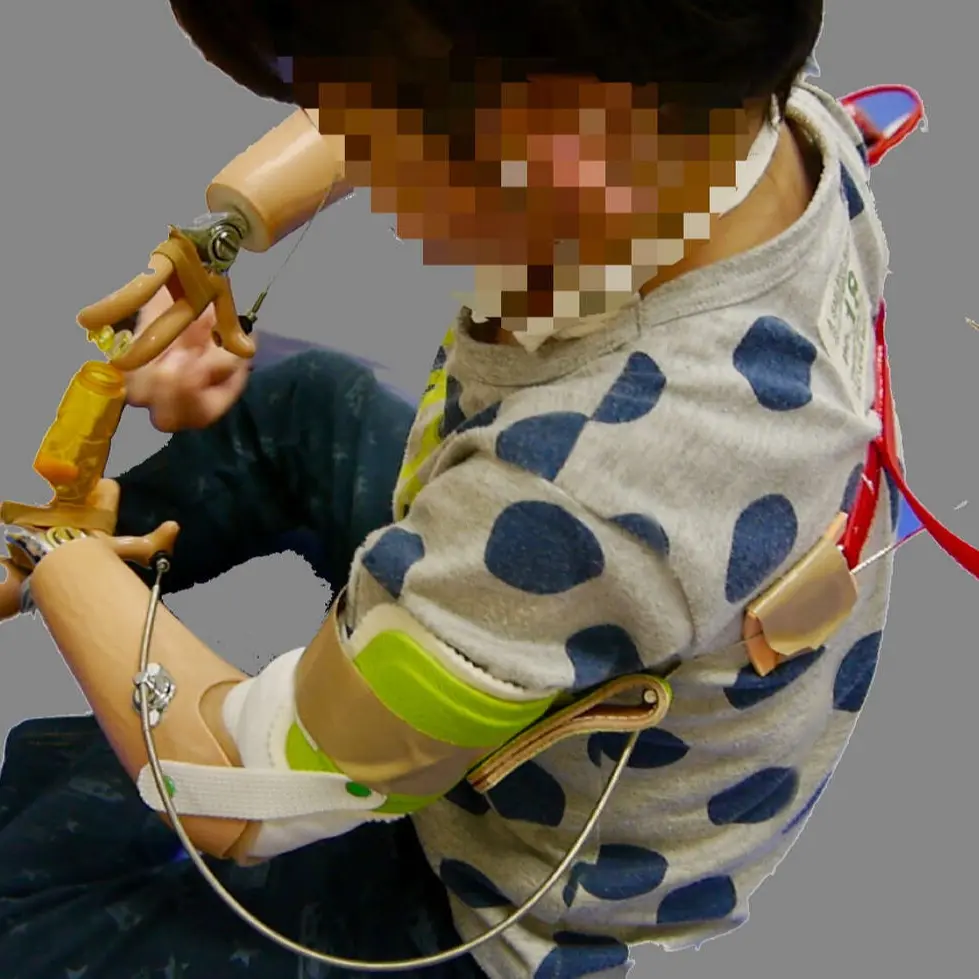 能動義手 子ども2