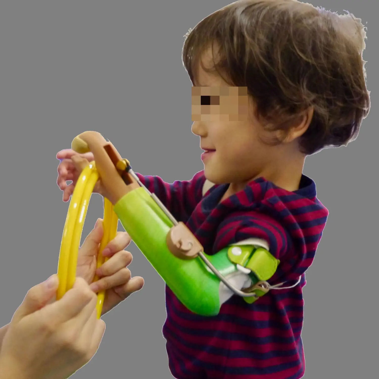 能動義手 子ども1