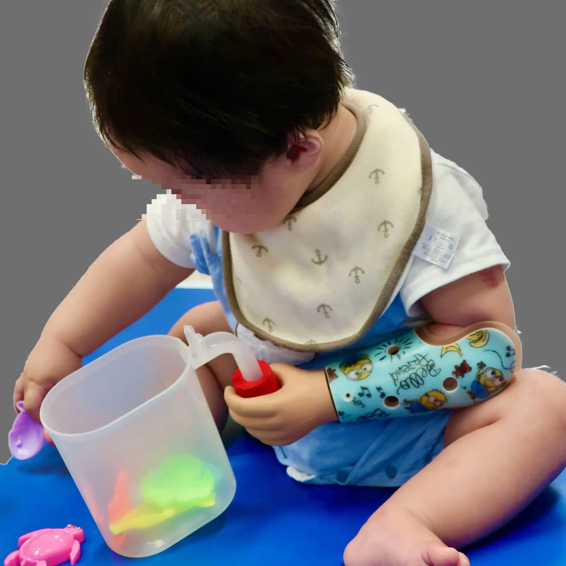 受動義手 子ども1